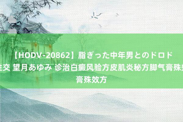 【HODV-20862】脂ぎった中年男とのドロドロ性交 望月あゆみ 诊治白癜风验方皮肌炎秘方脚气膏殊效方